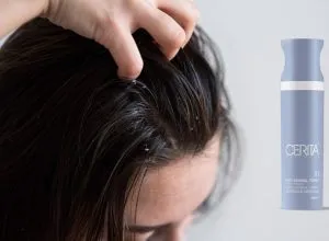 Cerita T1 anti dandruff tonic 1024x683 1
