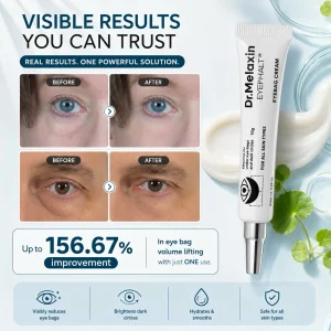 کرم دور چشم ضد پف و تیرگی دکتر ملاکسین 10 گرم 7 10 eyephalt ep eye cream for eyebags dr melaxin original imahzbzyq4qd27p5