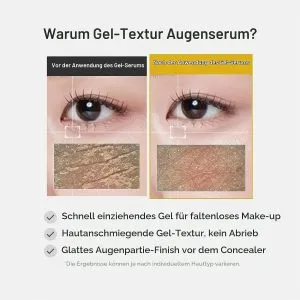 سرم دور چشم کوجیک اسید و زردچوبه مدی کیوب 30 میلیلیتر 6 71y7YvcvxhL. SL1500
